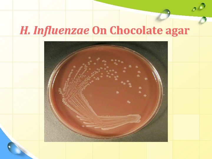 H. Influenzae On Chocolate agar H. Influenzae On Chocolate agar