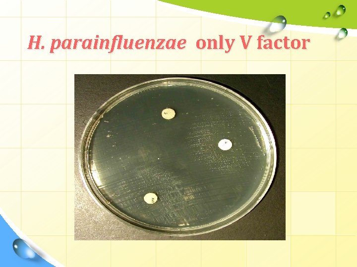 H. parainfluenzae only V factor H. parainfluenzae only V factor