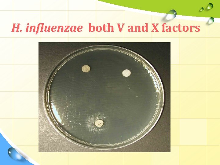 H. influenzae both V and X factors H. influenzae both V and X factors