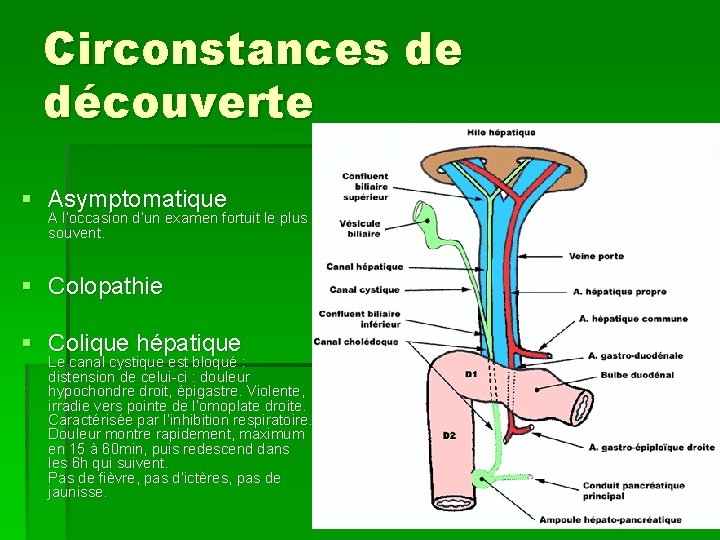 Circonstances de découverte § Asymptomatique A l’occasion d’un examen fortuit le plus souvent. §