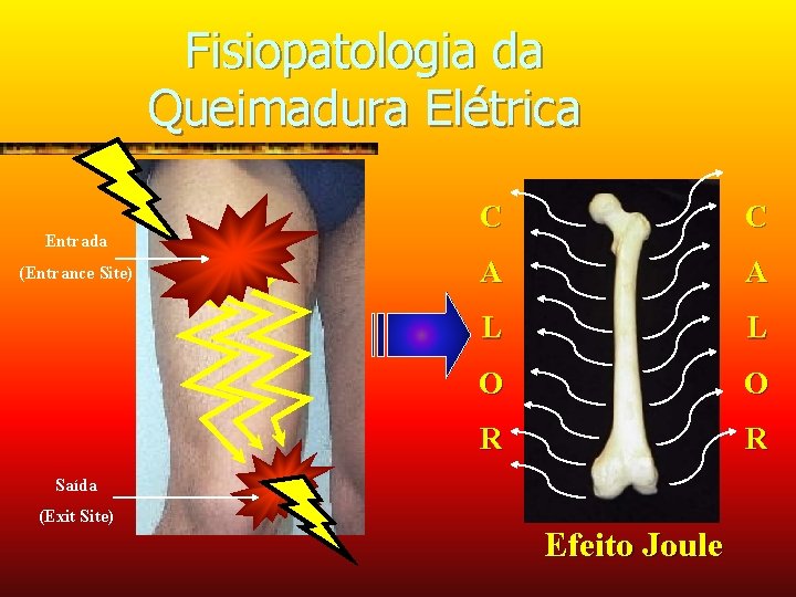Fisiopatologia da Queimadura Elétrica Entrada (Entrance Site) C C A A L L O