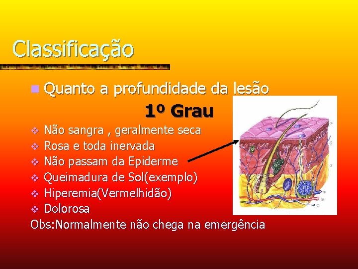 Classificação n Quanto a profundidade da lesão 1º Grau Não sangra , geralmente seca