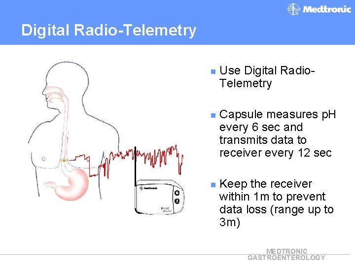 Digital Radio-Telemetry n Use Digital Radio. Telemetry n Capsule measures p. H every 6