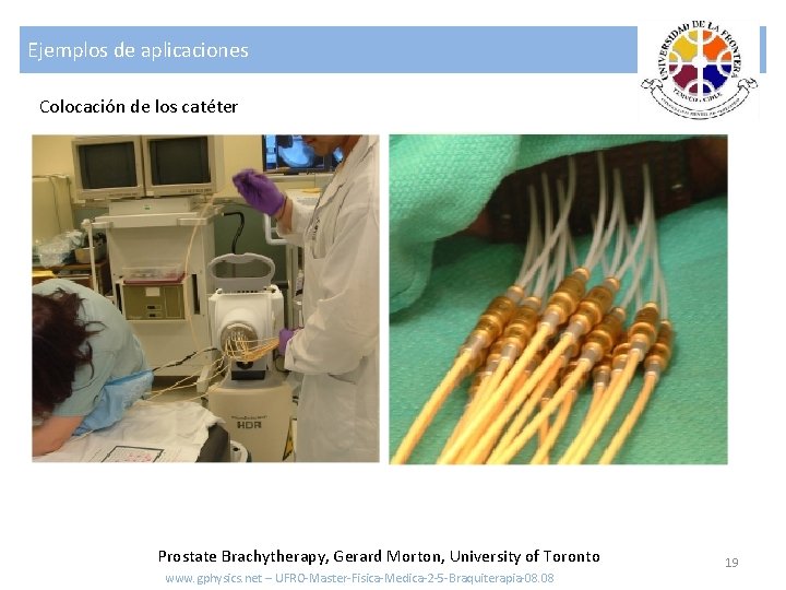 Ejemplos de aplicaciones Colocación de los catéter Prostate Brachytherapy, Gerard Morton, University of Toronto