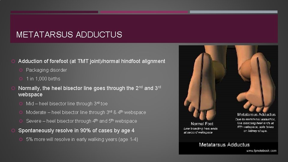 METATARSUS ADDUCTUS Adduction of forefoot (at TMT joint)/normal hindfoot alignment Packaging disorder 1 in