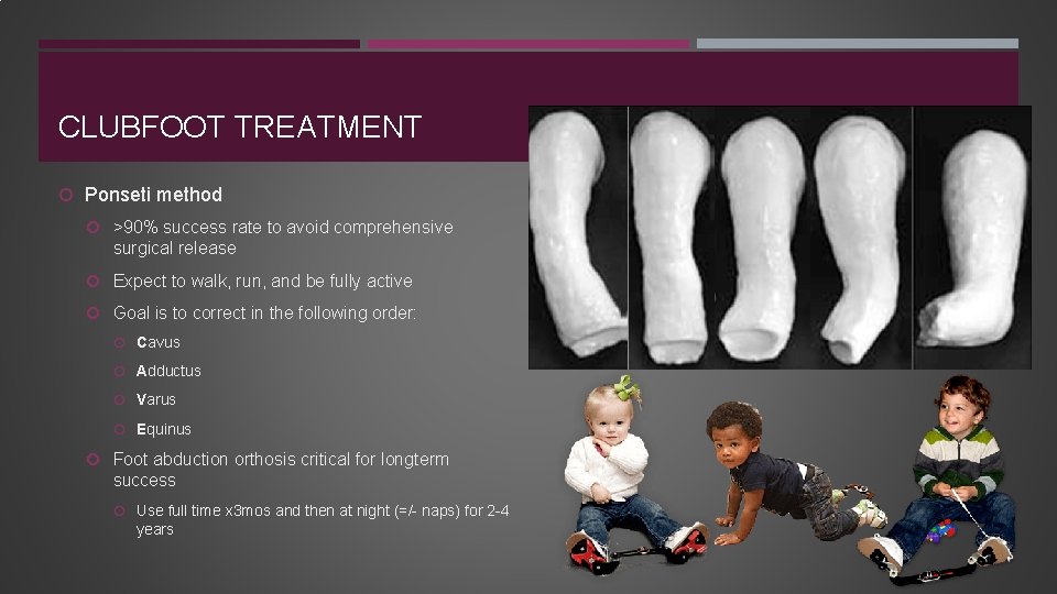 CLUBFOOT TREATMENT Ponseti method >90% success rate to avoid comprehensive surgical release Expect to