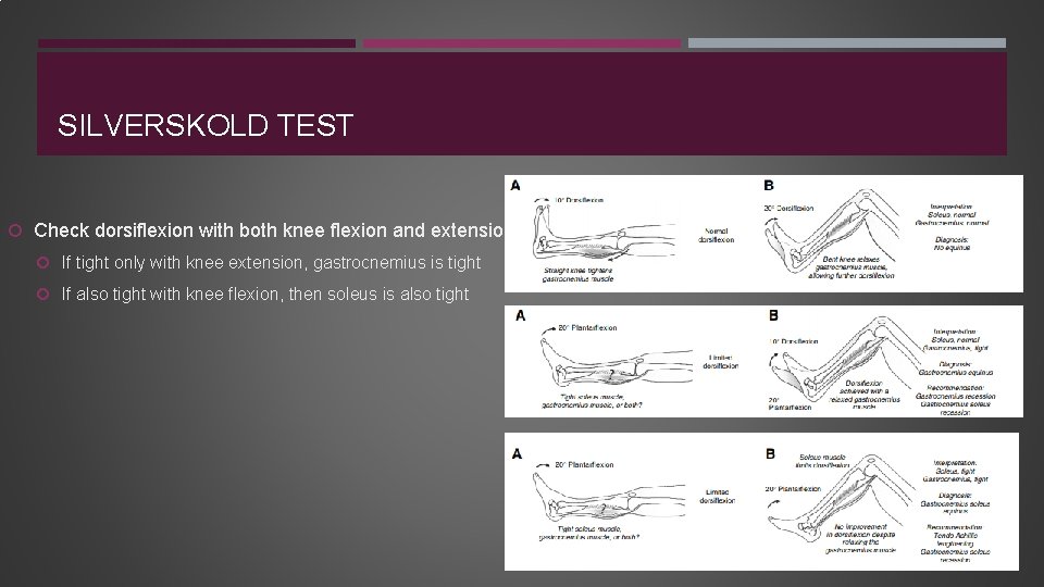 SILVERSKOLD TEST Check dorsiflexion with both knee flexion and extension If tight only with