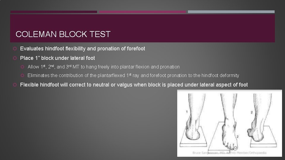 COLEMAN BLOCK TEST Evaluates hindfoot flexibility and pronation of forefoot Place 1” block under