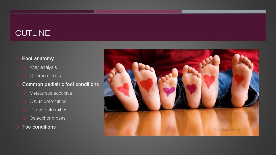 OUTLINE Foot anatomy Xray analysis Common terms Common pediatric foot conditions Metatarsus adductus Cavus