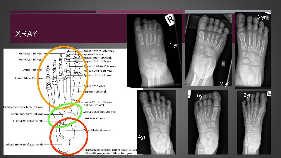 3 yr XRAY 1 yr 2 yr 5 yr 4 yr 6 yr 