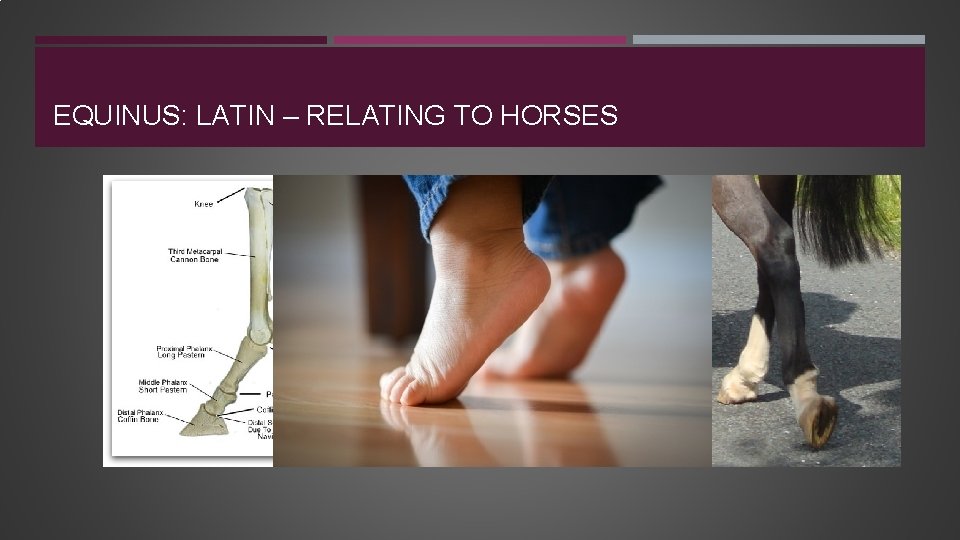 EQUINUS: LATIN – RELATING TO HORSES 