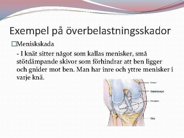 Exempel på överbelastningsskador �Meniskskada - I knät sitter något som kallas menisker, små stötdämpande