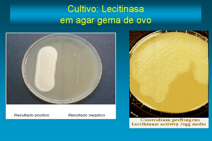 Cultivo: Lecitinasa em agar gema de ovo 