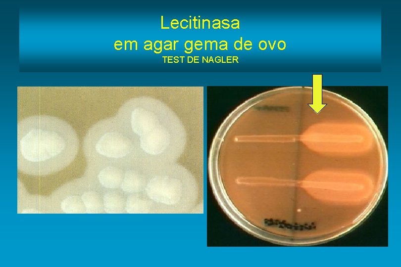 Lecitinasa em agar gema de ovo TEST DE NAGLER 