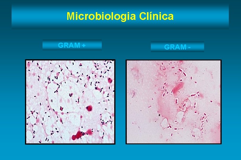 Microbiologia Clínica GRAM + GRAM - 