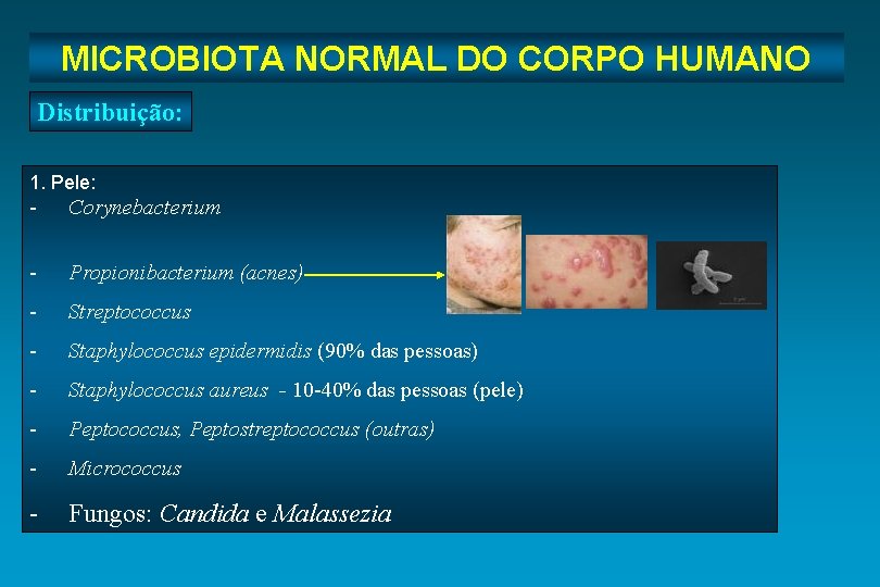 Microbiota Normal do Corpo Humano MICROBIOTA NORMAL DO CORPO HUMANO Distribuição: 1. Pele: -