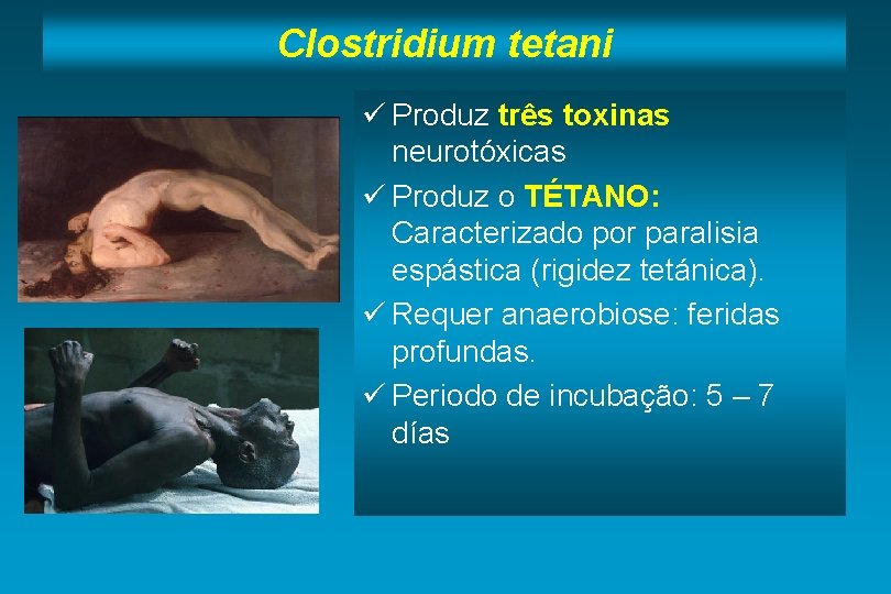 Clostridium tetani ü Produz três toxinas neurotóxicas ü Produz o TÉTANO: Caracterizado por paralisia