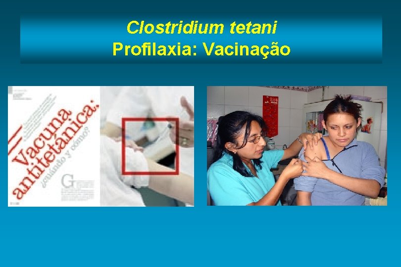 Clostridium tetani Profilaxia: Vacinação 