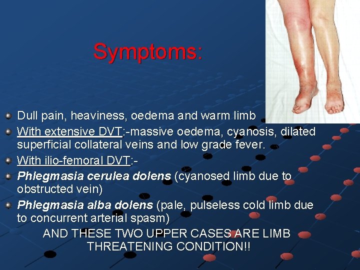 Symptoms: Dull pain, heaviness, oedema and warm limb With extensive DVT: -massive oedema, cyanosis,