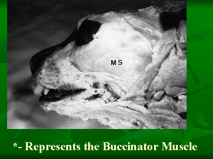 *- Represents the Buccinator Muscle 
