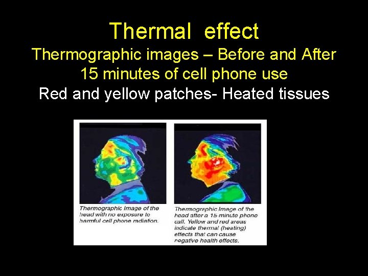 Thermal effect Thermographic images – Before and After 15 minutes of cell phone use