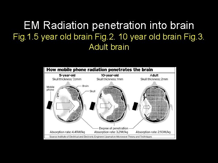 EM Radiation penetration into brain Fig. 1. 5 year old brain Fig. 2. 10