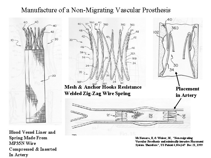 Manufacture of a Non-Migrating Vascular Prosthesis Mesh & Anchor Hooks Resistance Welded Zig-Zag Wire