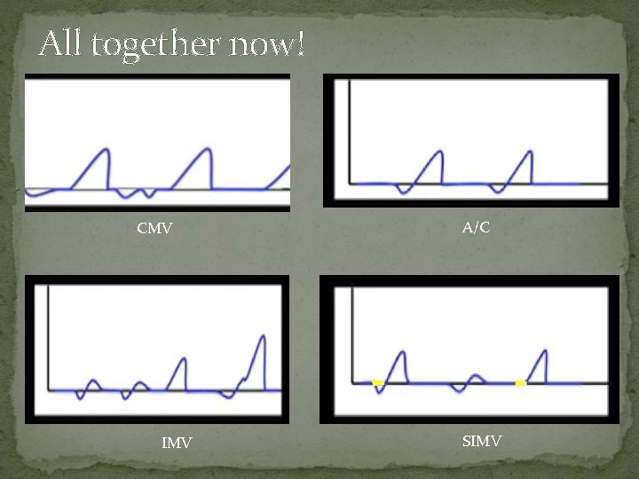 All together now! CMV IMV A/C SIMV 