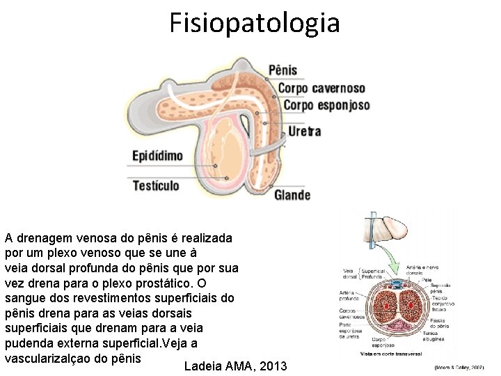 Fisiopatologia A drenagem venosa do pênis é realizada por um plexo venoso que se