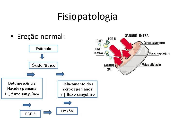 Fisiopatologia • Ereção normal: Estímulo Óxido Nítrico Detumescência Flacidez peniana + ↓ fluxo sanguíneo