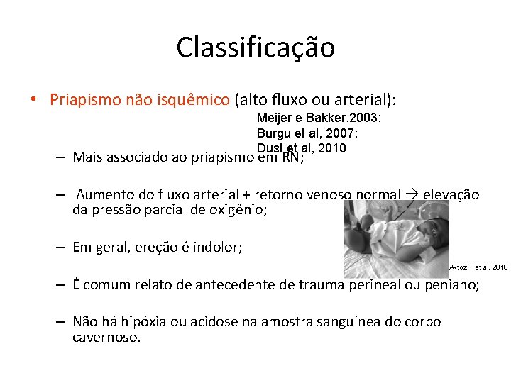 Classificação • Priapismo não isquêmico (alto fluxo ou arterial): Meijer e Bakker, 2003; Burgu