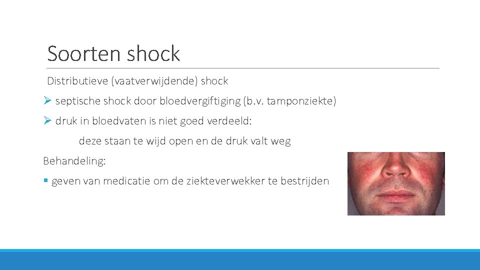 Soorten shock Distributieve (vaatverwijdende) shock Ø septische shock door bloedvergiftiging (b. v. tamponziekte) Ø