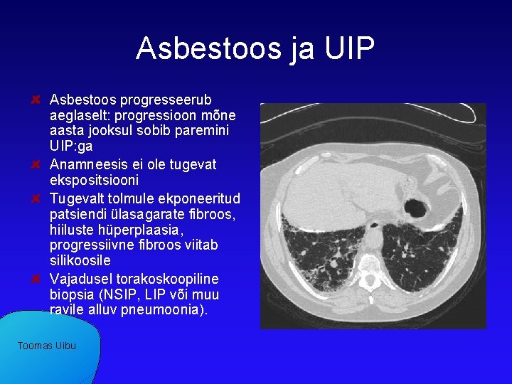 Asbestoos ja UIP Asbestoos progresseerub aeglaselt: progressioon mõne aasta jooksul sobib paremini UIP: ga