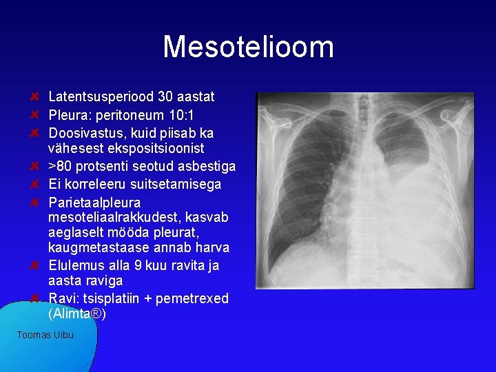 Mesotelioom Latentsusperiood 30 aastat Pleura: peritoneum 10: 1 Doosivastus, kuid piisab ka vähesest ekspositsioonist