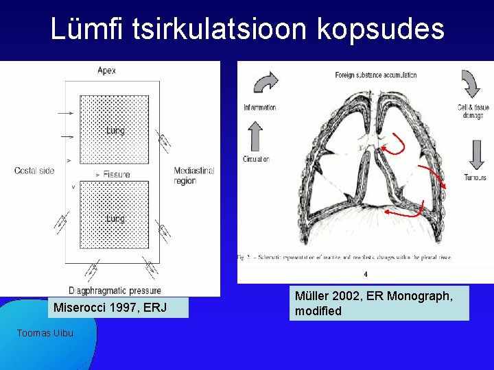 Lümfi tsirkulatsioon kopsudes Miserocci 1997, ERJ Toomas Uibu Müller 2002, ER Monograph, modified 