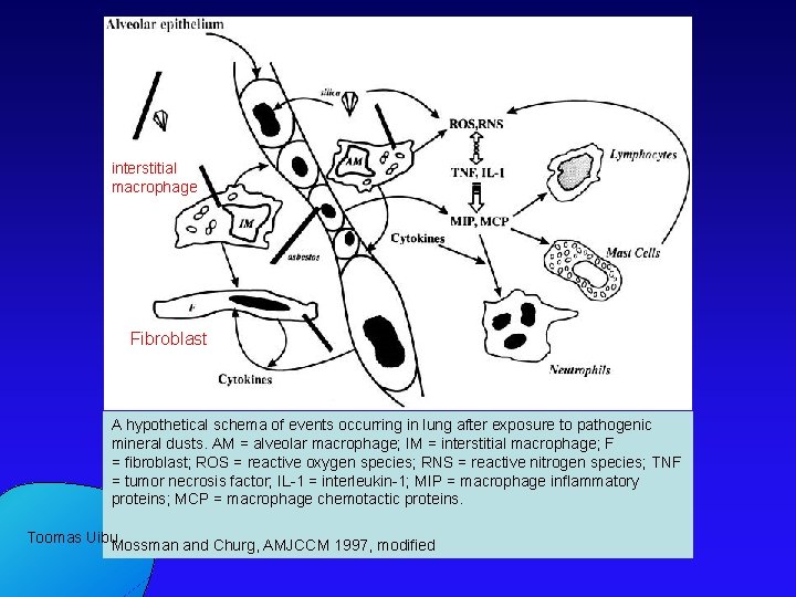 interstitial macrophage Fibroblast A hypothetical schema of events occurring in lung after exposure to