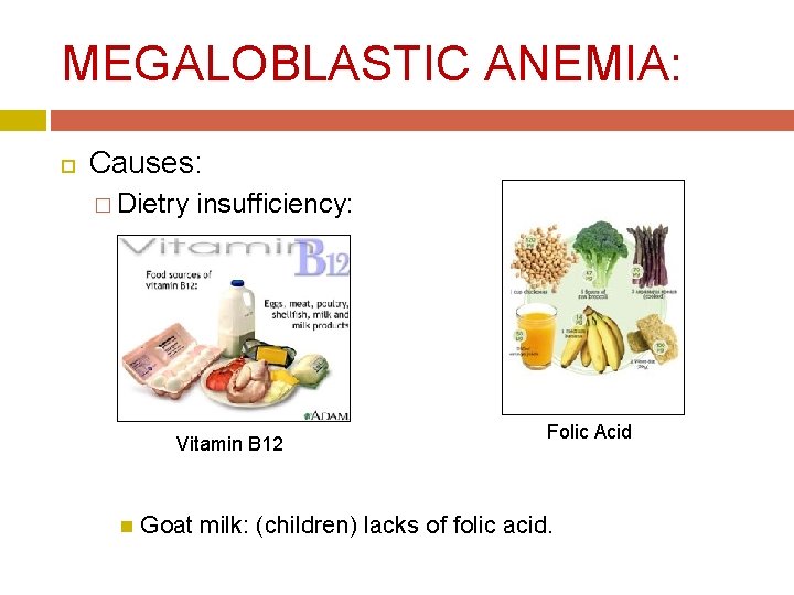 MEGALOBLASTIC ANEMIA: Causes: � Dietry insufficiency: Vitamin B 12 Folic Acid Goat milk: (children) MEGALOBLASTIC ANEMIA: Causes: � Dietry insufficiency: Vitamin B 12 Folic Acid Goat milk: (children)
