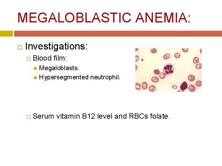 MEGALOBLASTIC ANEMIA: Investigations: � Blood film: Megaloblasts. Hypersegmented neutrophil. � Serum vitamin B 12 MEGALOBLASTIC ANEMIA: Investigations: � Blood film: Megaloblasts. Hypersegmented neutrophil. � Serum vitamin B 12