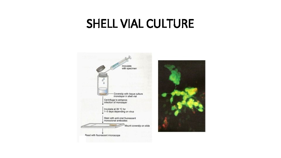 SHELL VIAL CULTURE 