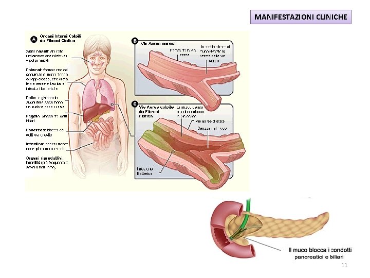 MANIFESTAZIONI CLINICHE 11 