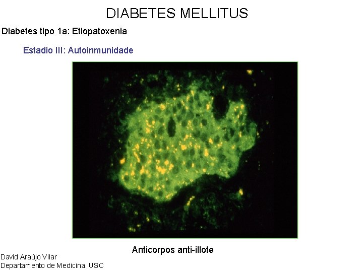 DIABETES MELLITUS Diabetes tipo 1 a: Etiopatoxenia Estadio III: Autoinmunidade David Araújo Vilar Departamento