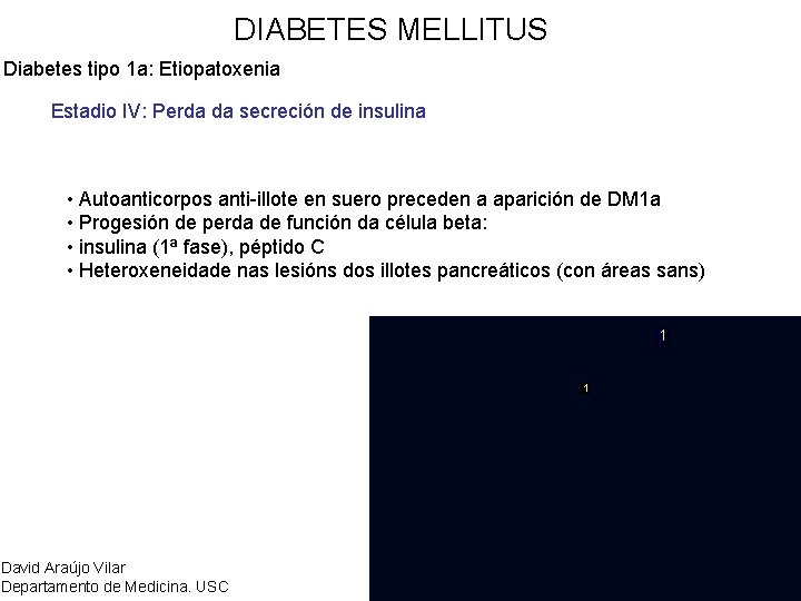 DIABETES MELLITUS Diabetes tipo 1 a: Etiopatoxenia Estadio IV: Perda da secreción de insulina