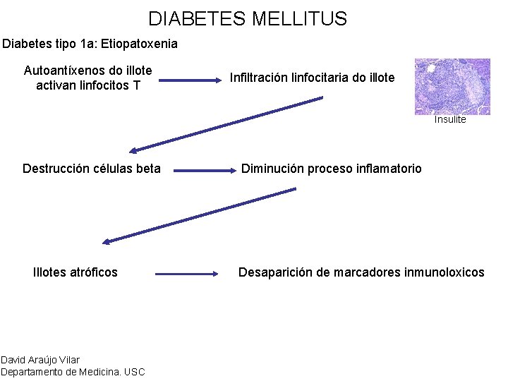 DIABETES MELLITUS Diabetes tipo 1 a: Etiopatoxenia Autoantíxenos do illote activan linfocitos T Infiltración