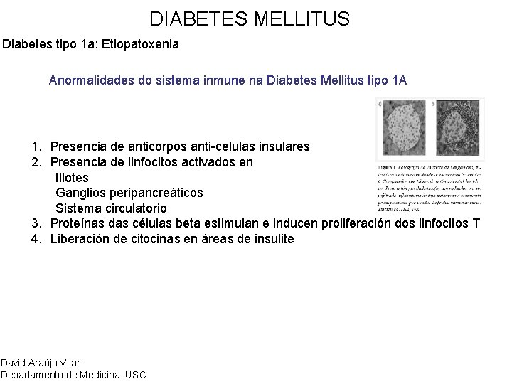 DIABETES MELLITUS Diabetes tipo 1 a: Etiopatoxenia Anormalidades do sistema inmune na Diabetes Mellitus