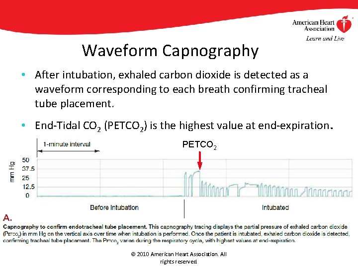 Waveform Capnography • After intubation, exhaled carbon dioxide is detected as a waveform corresponding Waveform Capnography • After intubation, exhaled carbon dioxide is detected as a waveform corresponding