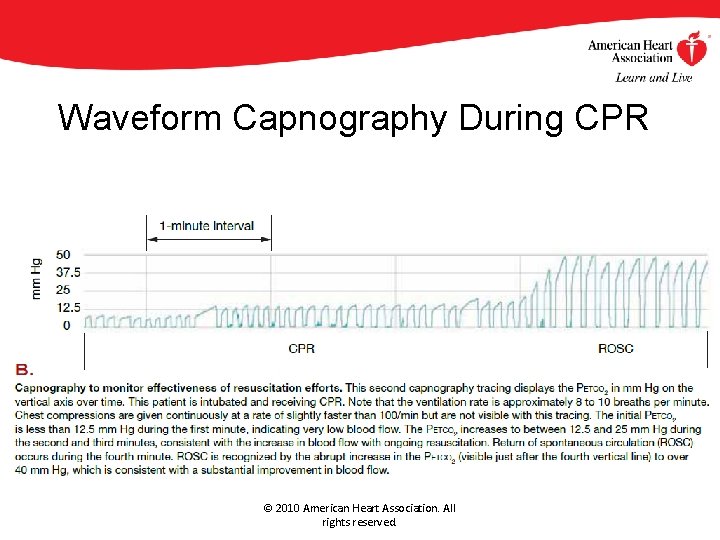 Waveform Capnography During CPR © 2010 American Heart Association. All rights reserved. Waveform Capnography During CPR © 2010 American Heart Association. All rights reserved.