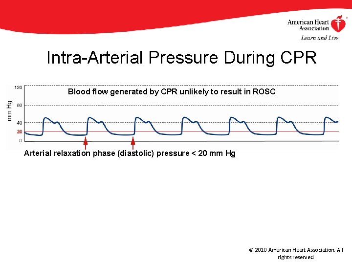 Intra-Arterial Pressure During CPR Blood flow generated by CPR unlikely to result in ROSC