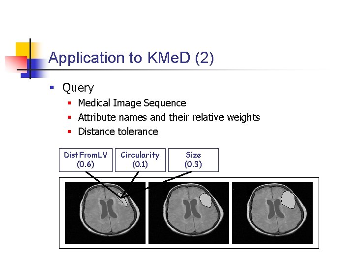 Application to KMe. D (2) § Query § Medical Image Sequence § Attribute names