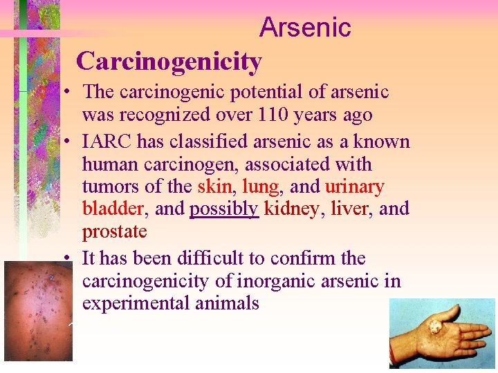 Arsenic Carcinogenicity • The carcinogenic potential of arsenic was recognized over 110 years ago