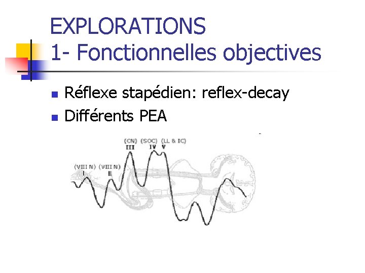 EXPLORATIONS 1 - Fonctionnelles objectives n n Réflexe stapédien: reflex-decay Différents PEA 